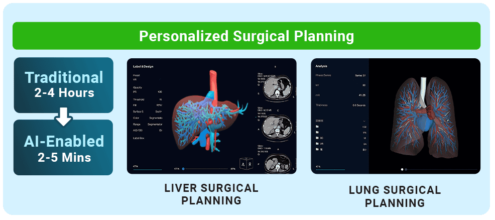 Personalized Surgical Planning